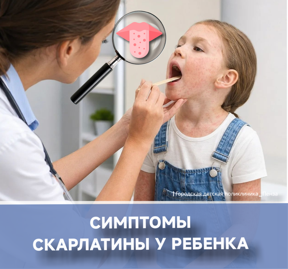 Про симптомы скарлатины у детей /Врач-инфекционист Е.Сучкова/